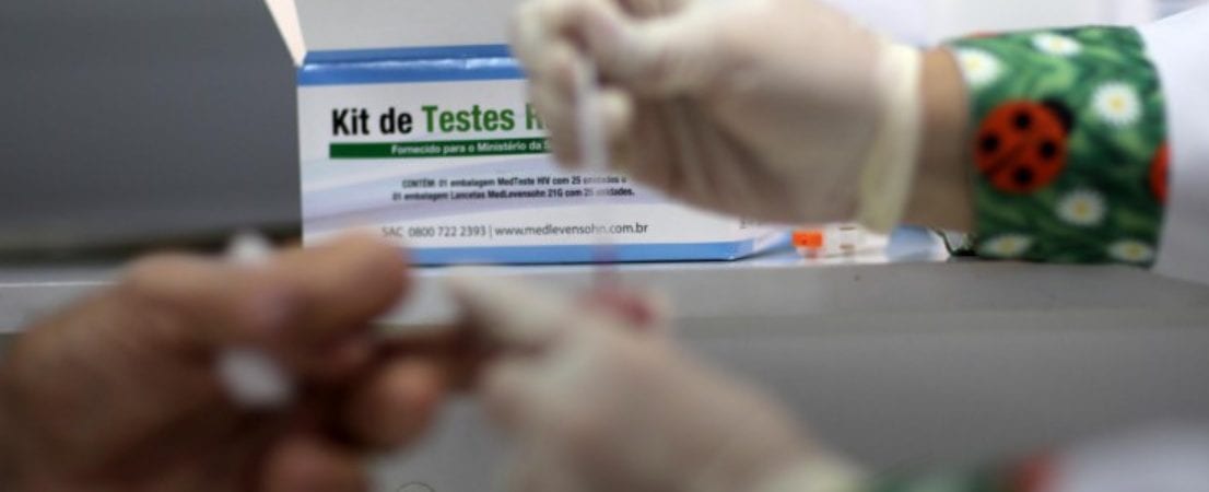 Governo suspende temporariamente exame que define tratamento para HIV e hepatites virais