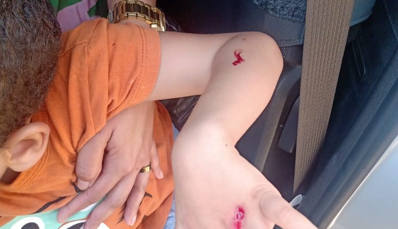 Criança sofre cortes nos braços e na cabeça após ser atingida por cacos de vidro de uma proteção instalada em ponto de ônibus