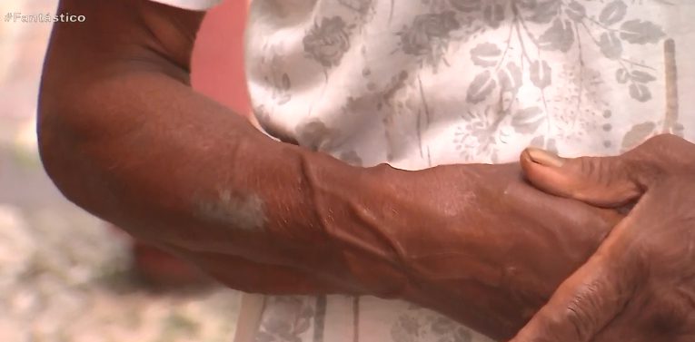 Patroa que agrediu babá em Salvador é acusada de esfaquear funcionária idosa