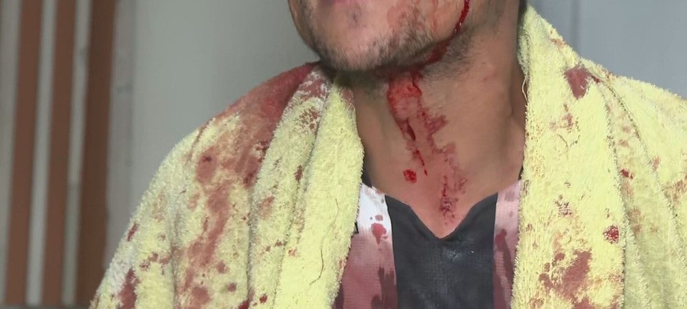 Festa do Galo: Vitória do Atlético é marcada por torcedores feridos e homem esfaqueado