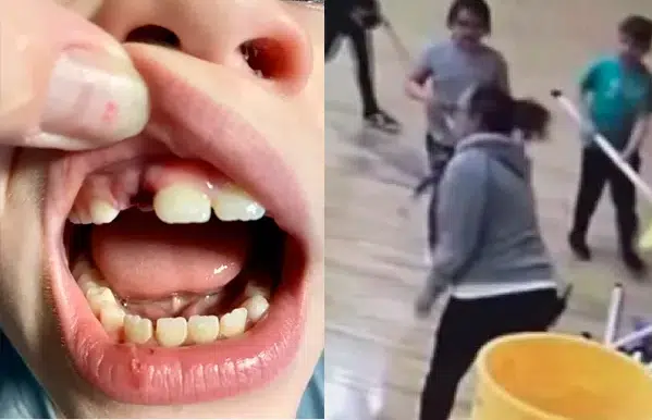 Professora é flagrada quebrando dente de aluno de 8 anos com taco
