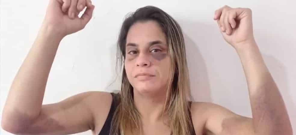 Alagoinhas: Empresária relata ter sofrido agressões do ex-companheiro por 2 anos