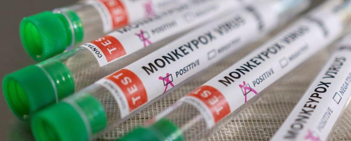 Salvador confirma mais dois casos de varíola dos macacos