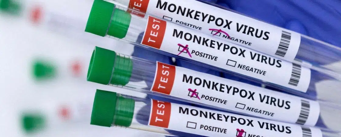 Varíola dos Macacos: Ministério da Saúde lança campanha de prevenção