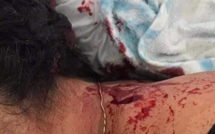 Camaçari: Comerciante que tentou matar ex-mulher a facadas está foragido 