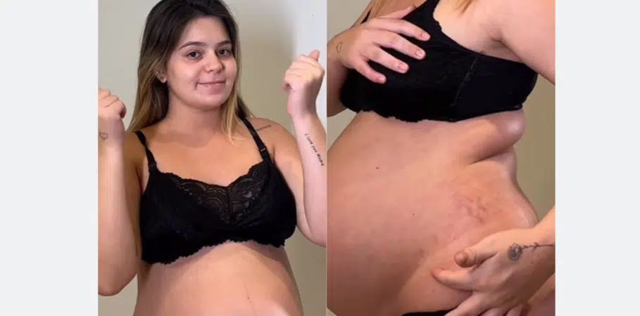 Vídeo: Viih Tube mostra as cicatrizes do corpo em final de gravidez