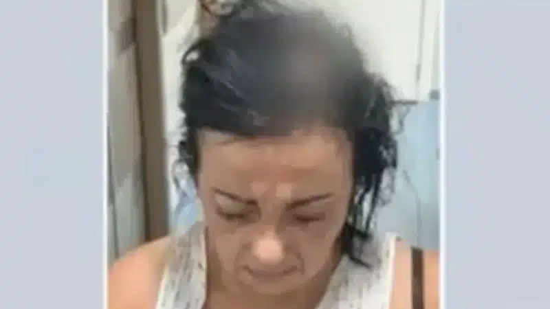 Professora leva pontos após ser agredida em assalto na porta de uma creche em Salvador