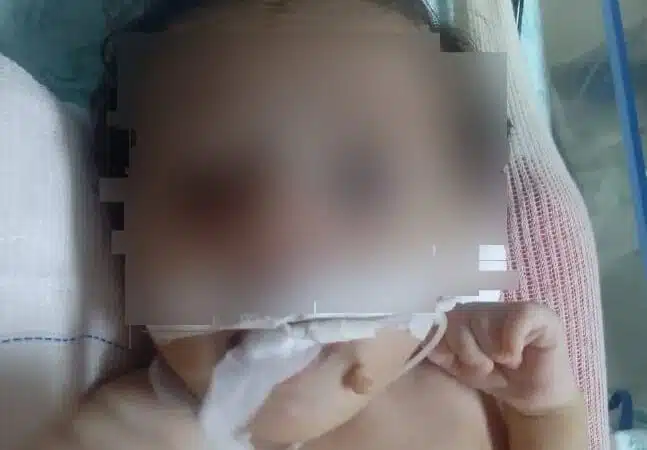 Morre bebê que teve leite injetado na veia no lugar de remédio em hospital