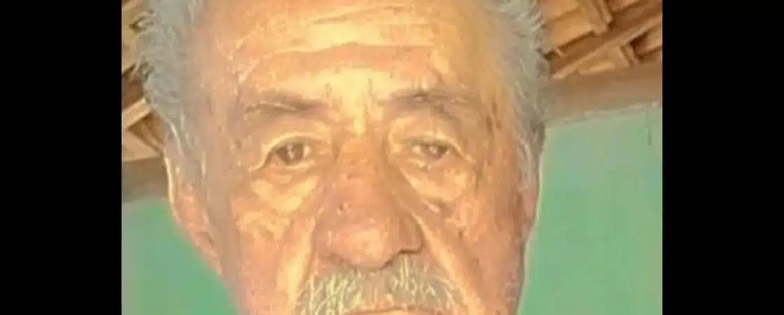 BA: Idoso de 92 anos morre após ser picado por escorpião