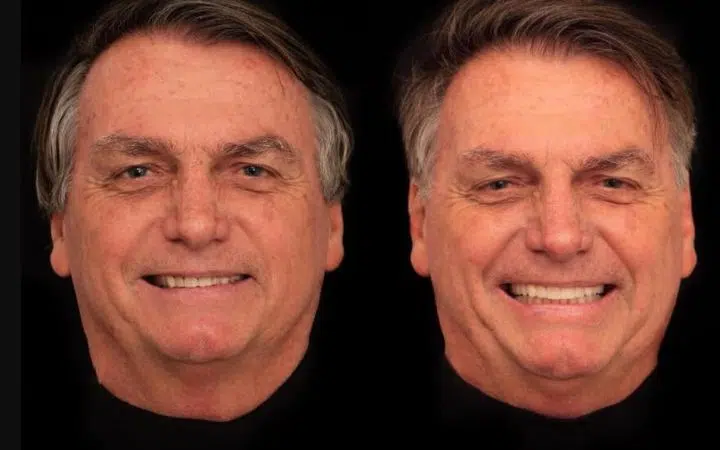 Bolsonaro muda visual com harmonização facial e choca na internet