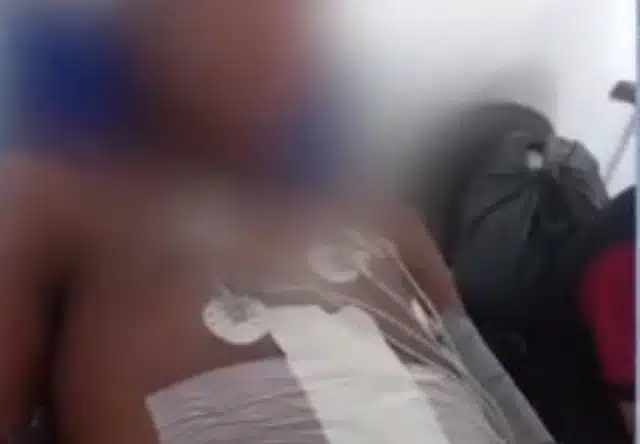 Menor perde baço e tem intestino perfurado após ser baleado durante operação policial na BA
