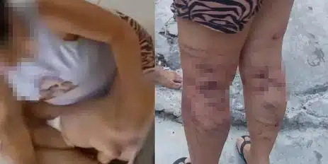 Mulher acusada de maltratar criança em creche é espancada em Salvador