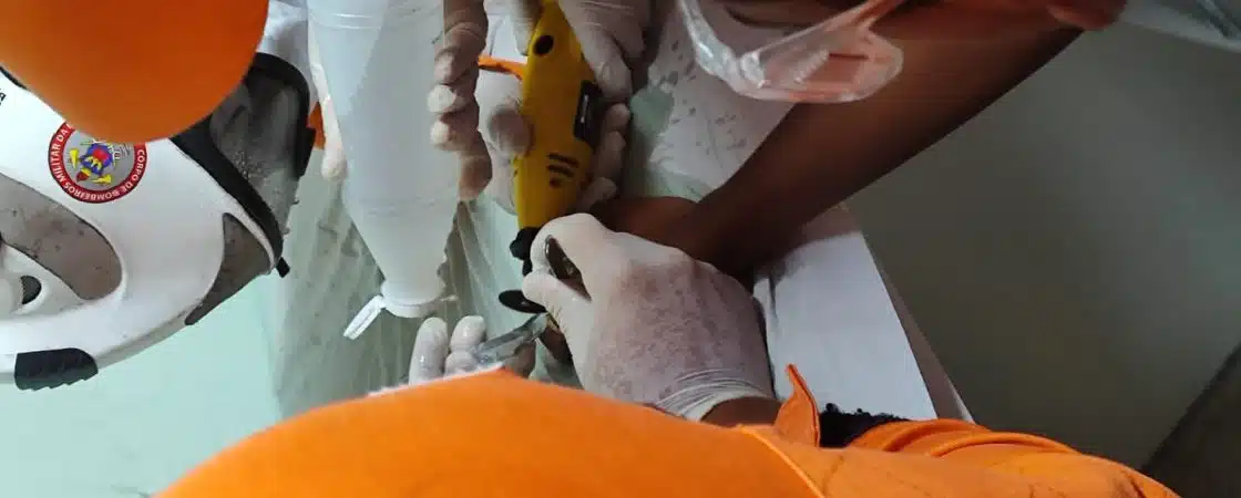VÍDEO: anel é retirado do dedo de adolescente por bombeiros de Camaçari