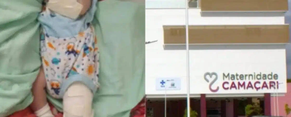Bebê morre e outro tem a perna quebrada na Maternidade de Camaçari