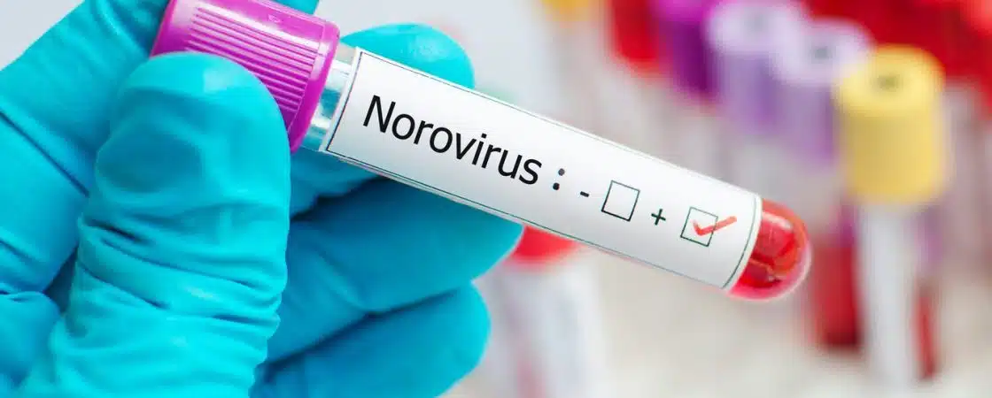 Sesau alerta sobre aumento de casos de norovírus em Camaçari