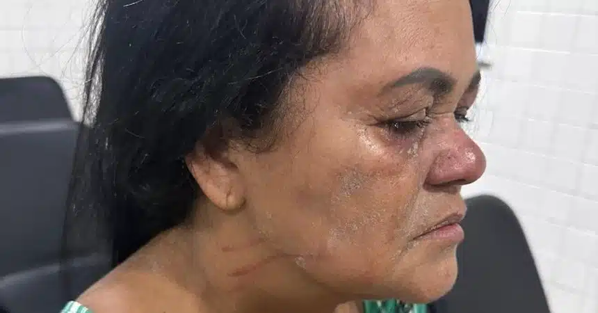 CAMAÇARI: Pastora é agredida enquanto andava de moto