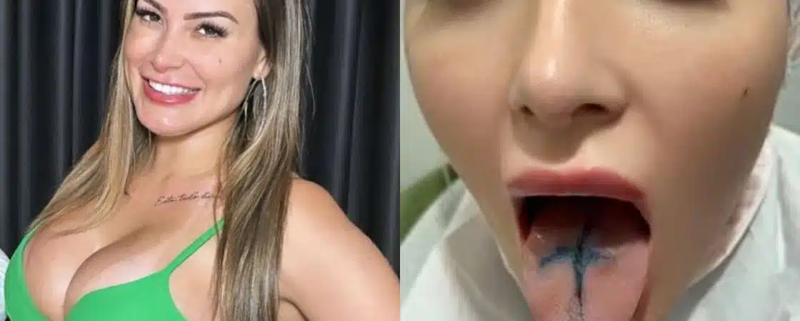 Andressa Urach faz cirurgia para dividir a língua e choca internautas