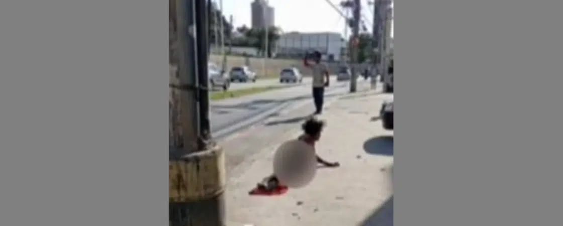 Homem tem mão amputada após roubar cabos de energia em Salvador